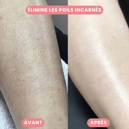 SilkTrim™ - Tondeuse 2-en-1 pour le Maillot et le Visage